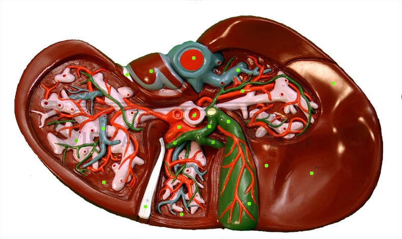 Large Liver: Ventral View